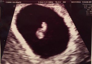 Baby's First Ultrasound - 6 weeks